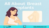 ShohozNews Breast Implants: Complete Guide, Types, and Safety