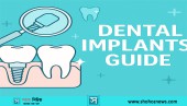 ShohzNews Dental Implants Guide: Procedure, Benefits and Costs