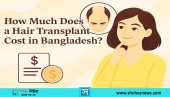 বাংলাদেশে হেয়ার ট্রান্সপ্লান্টের খরচ কত?